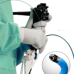 Spyglass Cholangioscopy